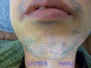 HARUP1010751