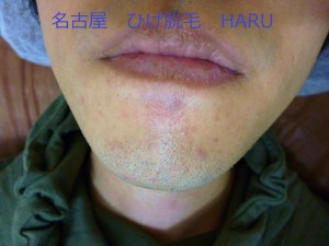 HARUP1000560