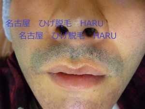 HARUP1010091