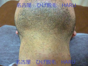 HARUP1010677