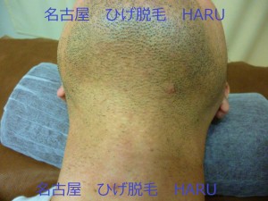 HARUP1010810