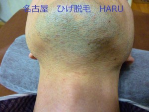 HARUP1010952