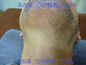 HARUP1010967