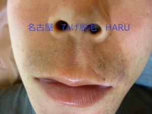 HARUP1030065