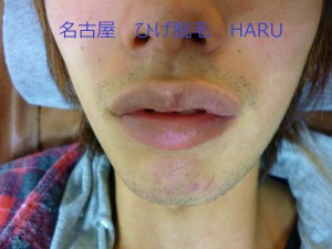 HARUP1000572