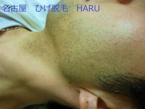 HARUP1030268