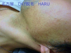 HARUP1030739