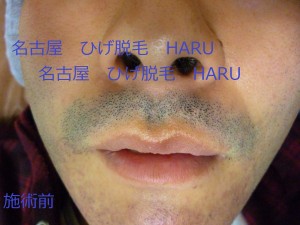 HARUP1010091