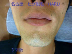 HARUP1010863