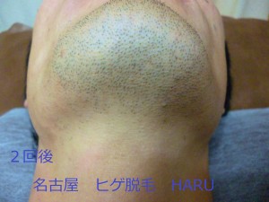 HARUP1010864