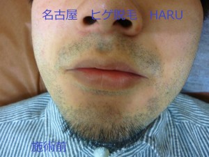 HARUP1060130