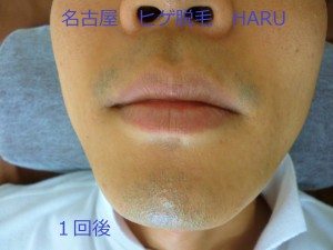 HARUP1060501