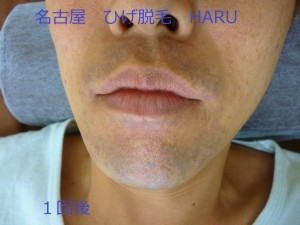 HARUP1060524