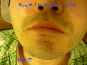 HARUP1060304