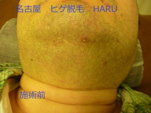 HARUP1060306