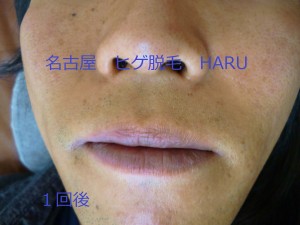 HARUP1060757