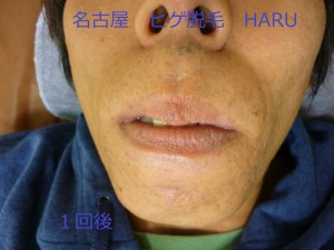 HARUP1060798