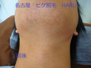 HARUP1060880