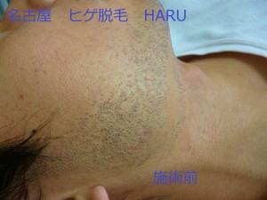 HARUP1060478