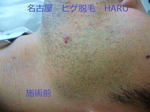 HARUP1060754