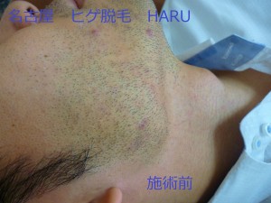 HARUP1060755