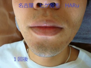 HARUP1060984