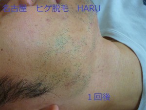 HARUP1060988