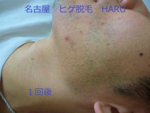 HARuP1060987