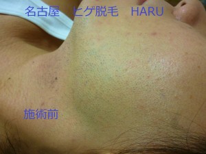 HARUP1060588