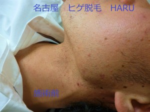 HARUP1070003