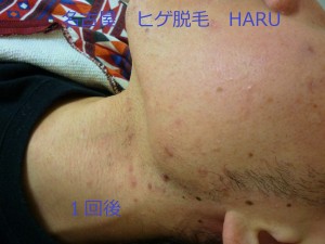 HARUP1070212