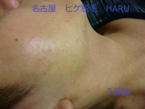 HARUP1070227