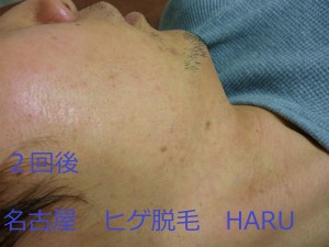 HARUP1070504