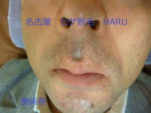 HARUP1010021