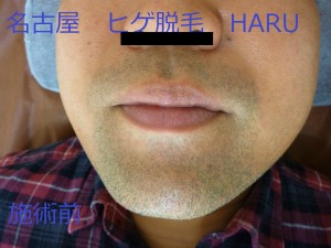 HARUP1070109