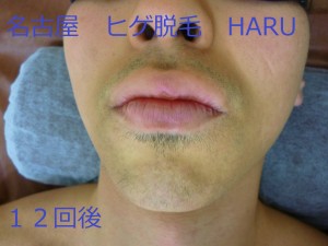 HARUP1070587