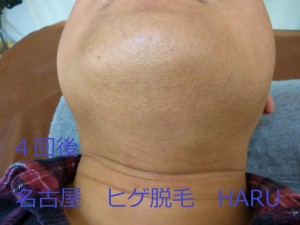 HARUP1070728