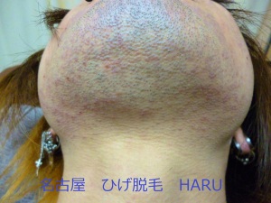 HARUP1010935