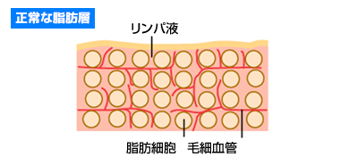 正常な脂肪層