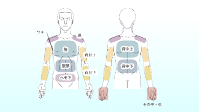 上半身脱毛セット